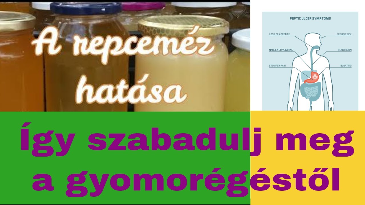 A repcem&eacute;z hat&aacute;sa - gyomorsav, gyomor&eacute;g&eacute;s, reflux ellen