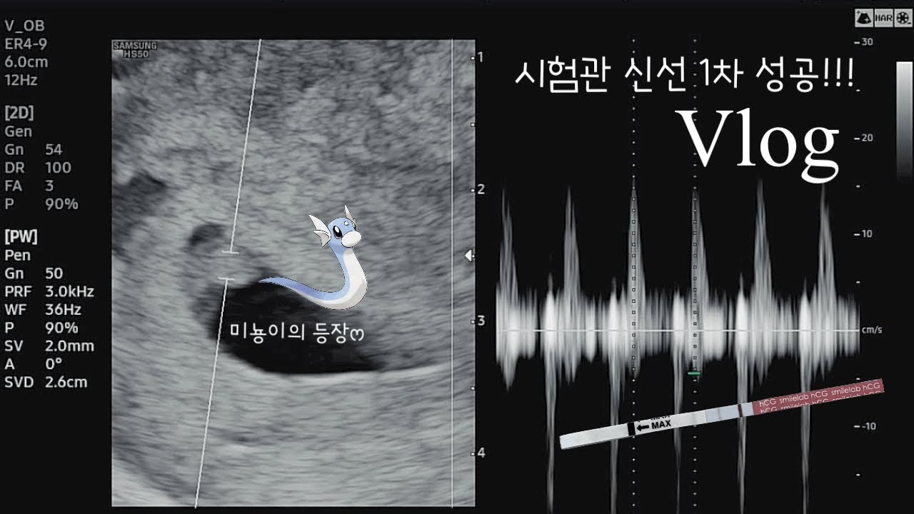 [vlog] 시험관 1차 성공👶🏻 | 1~3차 피검 | 아기집, 난황확인 | 심장소리 | 나도 청룡띠 맘ෆ