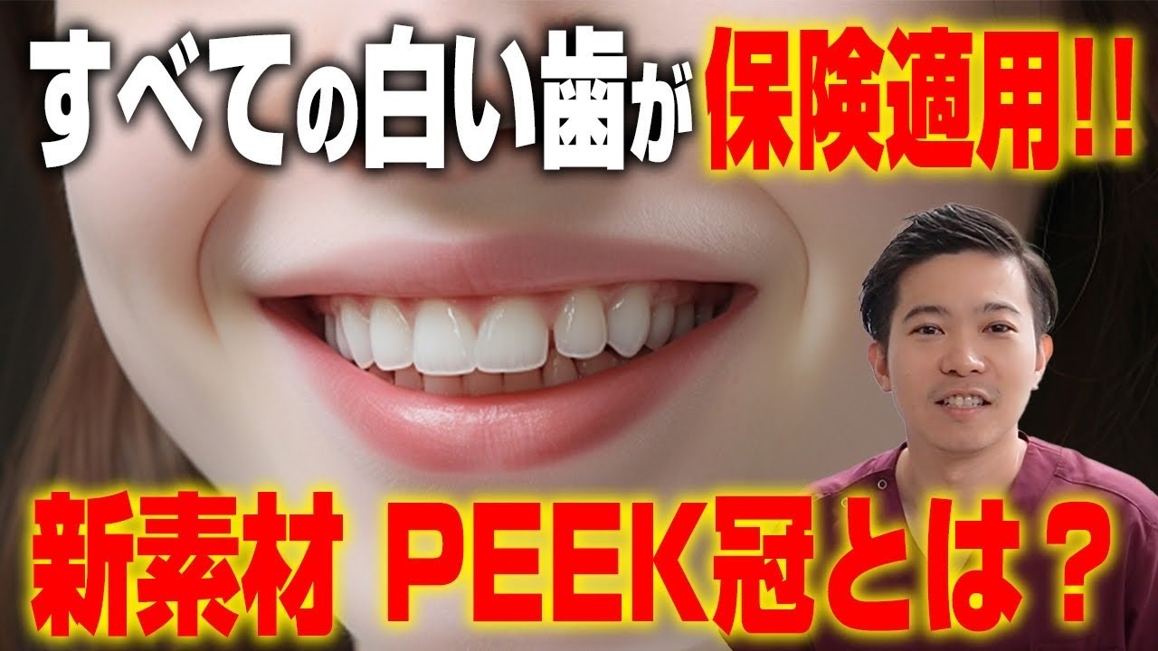 すべての歯が保険治療で白くできます！