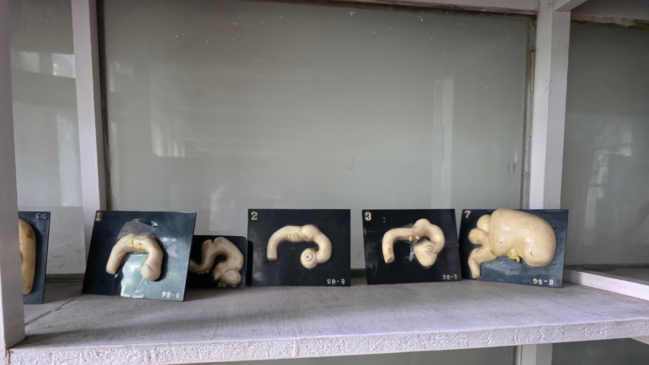 “Brain Development in Embryology | Vesiculation with 3D Models”