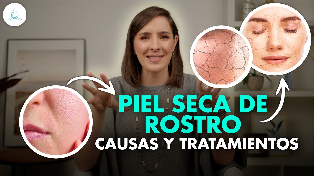 🔴 PIEL SECA o DESHIDRATADA ¡Causas y Tratamientos! @drapilarochoa - Dermatologa