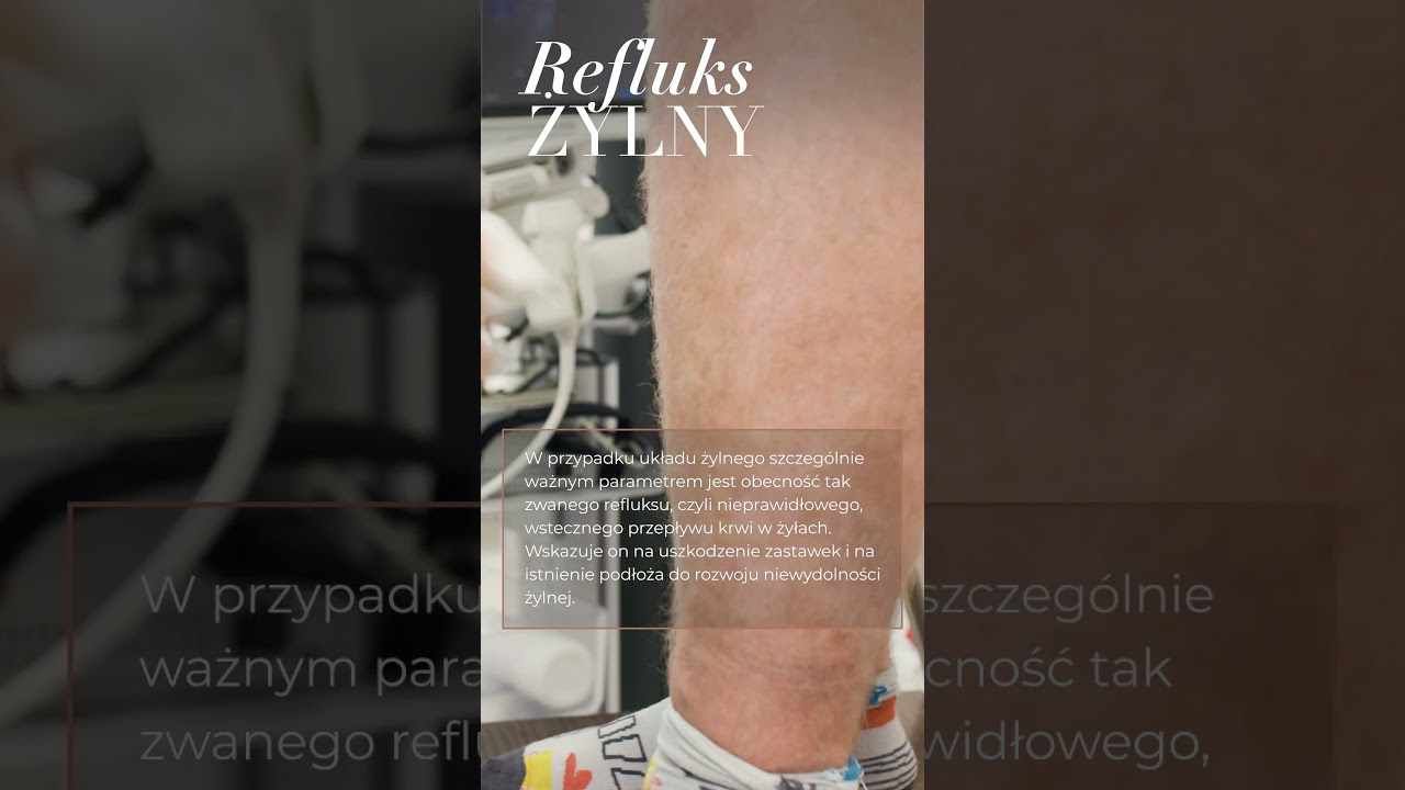 Jak wygląda badanie USG Doppler?👏🏻 Diagnostyka żylak&oacute;w i niewydolności żylnej