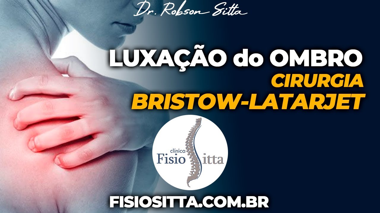 LUXAÇÃO OMBRO CIRURGIA BRISTOW LATARJET INSTABILIDADE ANTERIOR Clínica Fisioterapia Dr. Robson Sitta
