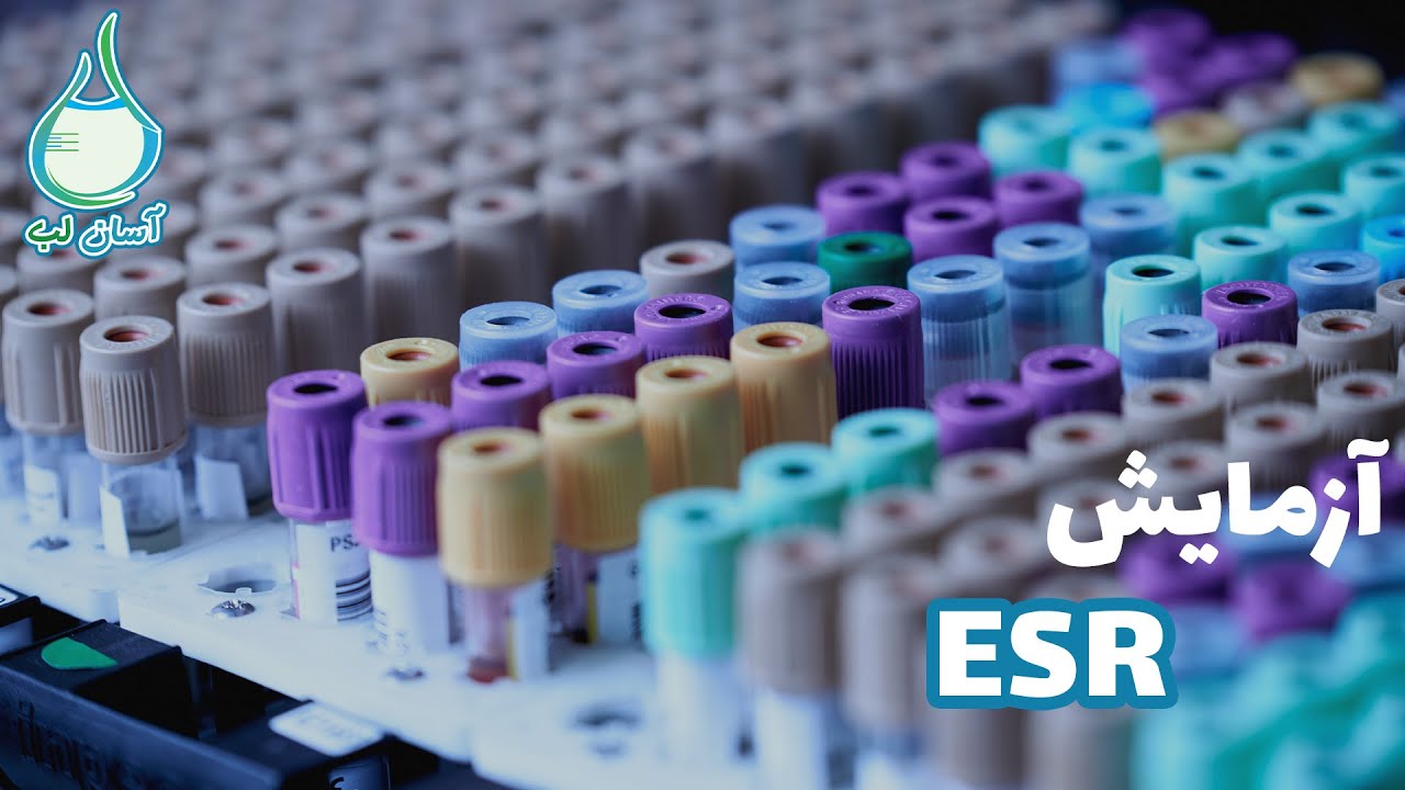 آزمایش خون و بررسی عفونت | آزمایش کرونا و عفونت | ESR آزمایش