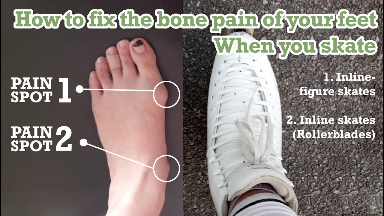How to fix the ankle & feet bone pain from your skate boots (feat. a gel pad)