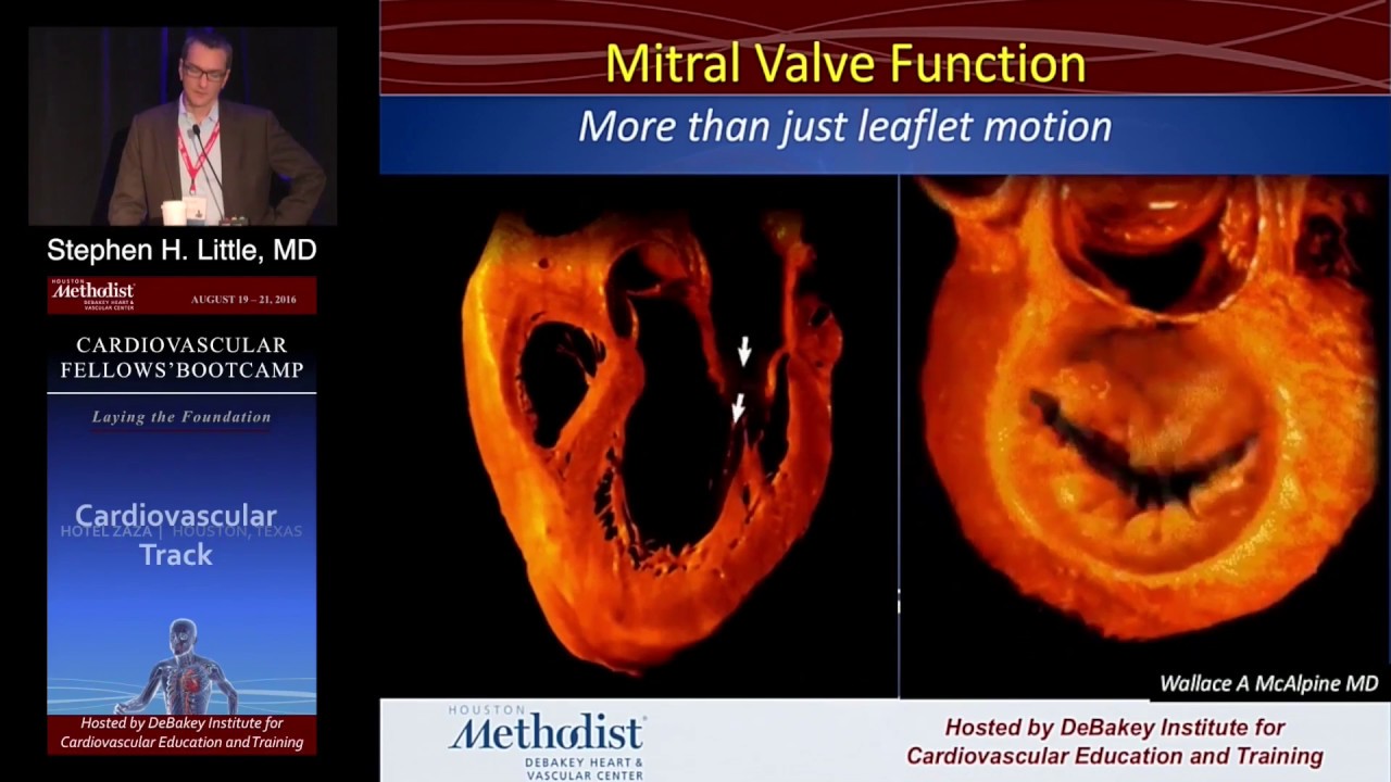 Mitral Stenosis (Stephen H. Little, MD)  Sunday, August 21, 2016