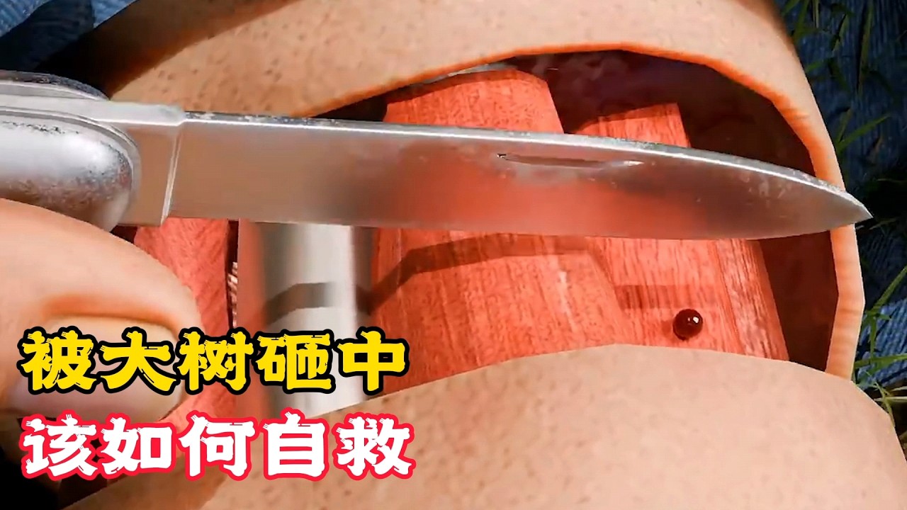 倒楣的男子，竟被大樹砸中腿，怎樣才能自救？科普動畫《被大樹砸中》。電影，短片，成精，解說，搞笑，動畫，動作，喜劇，獵奇，奇幻，腦洞，科幻，超能力，short film