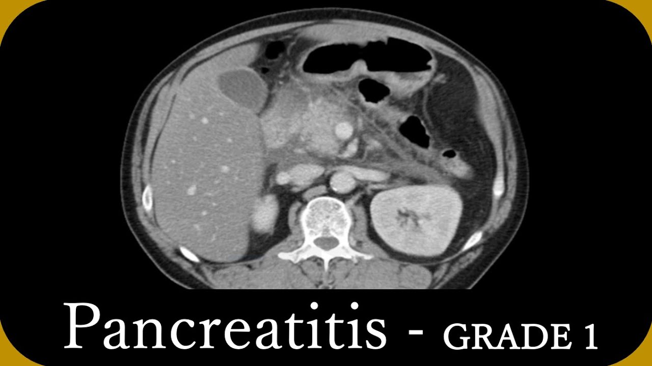 Imaging diagnosis of 