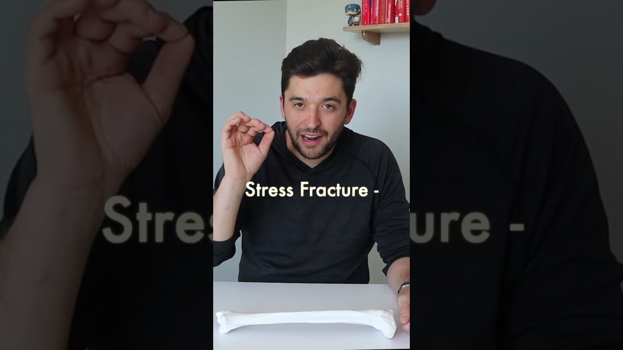 Does my MRI grade matter with a stress fracture? #shorts #stressfractures