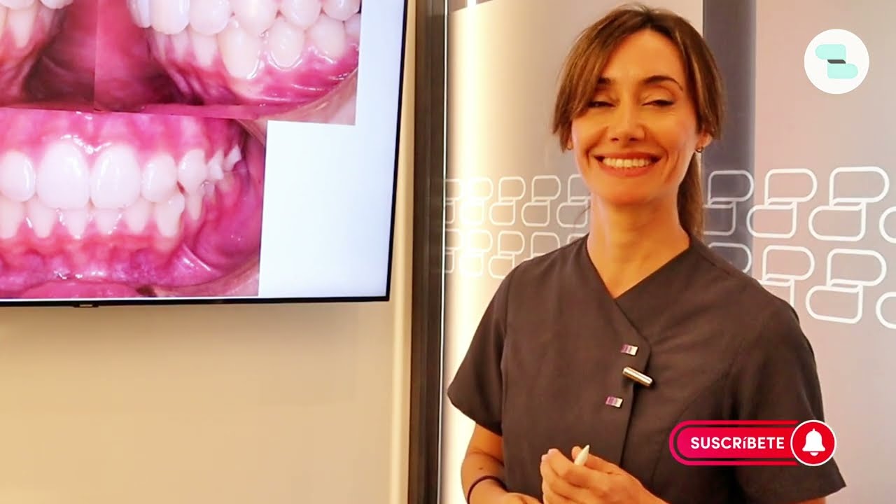 Ortodoncia invisible, ¡corregimos su avance mandibular!