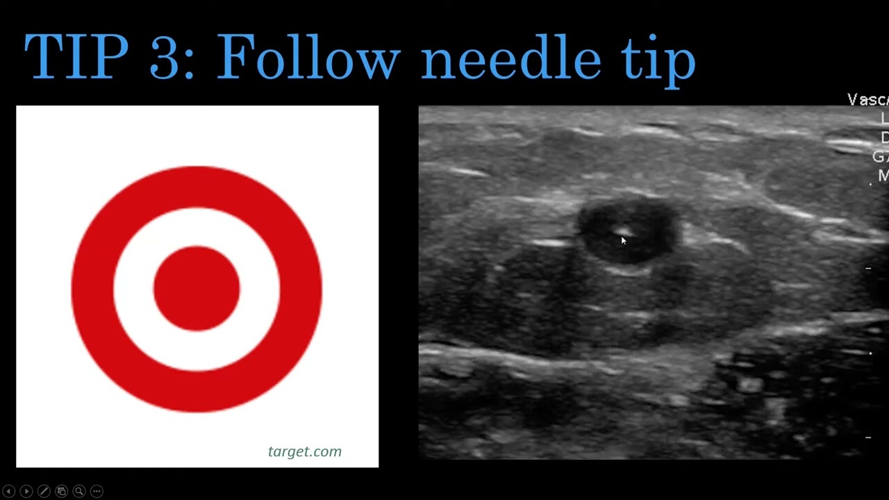 Vascular Access  Exam Protocol Tips & Technique