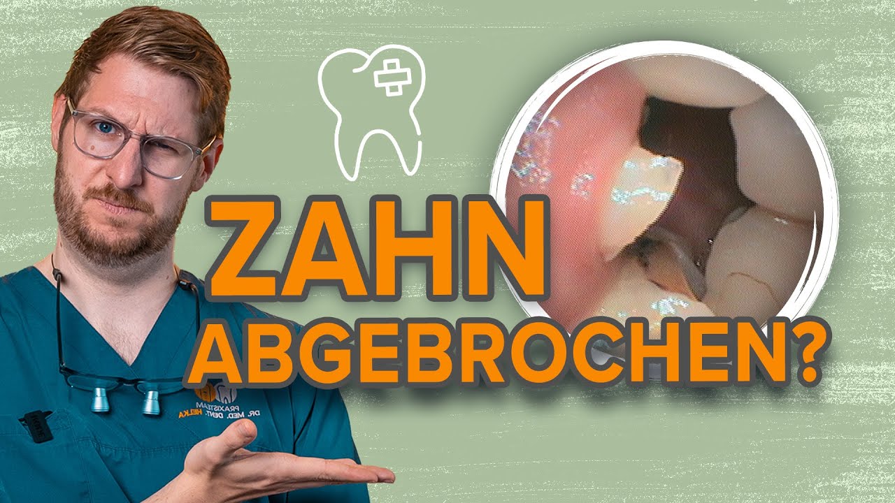 So retten wir deinen abgebrochenen Zahn