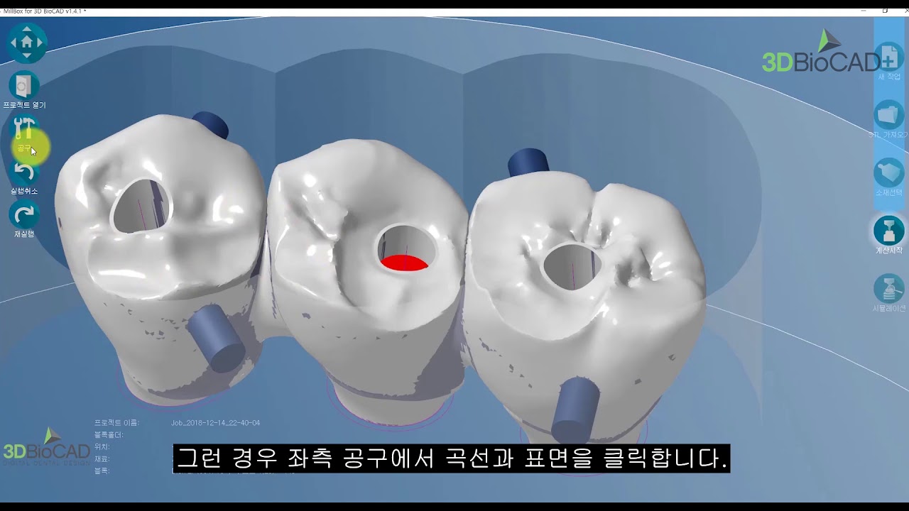 3DBioCAD - Millbox SCRP Crown 설정법