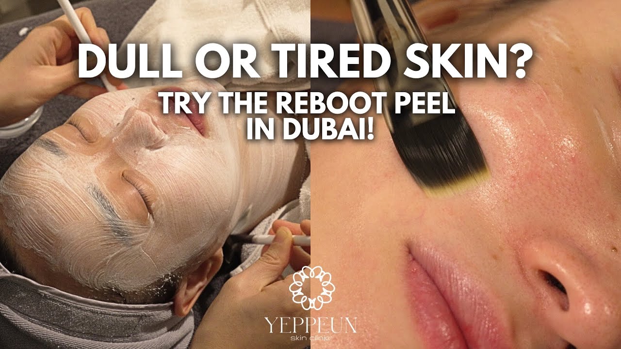 Dull or Tired Skin? Try the Reboot Peel in Dubai | SKIN CLINIC IN DUBAI 