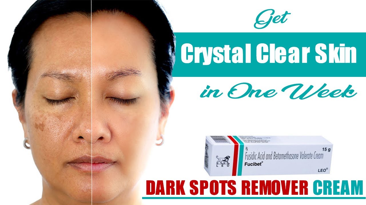 Fucibet Cream Uses, Price, and Side Effects | Dark spot remover for face