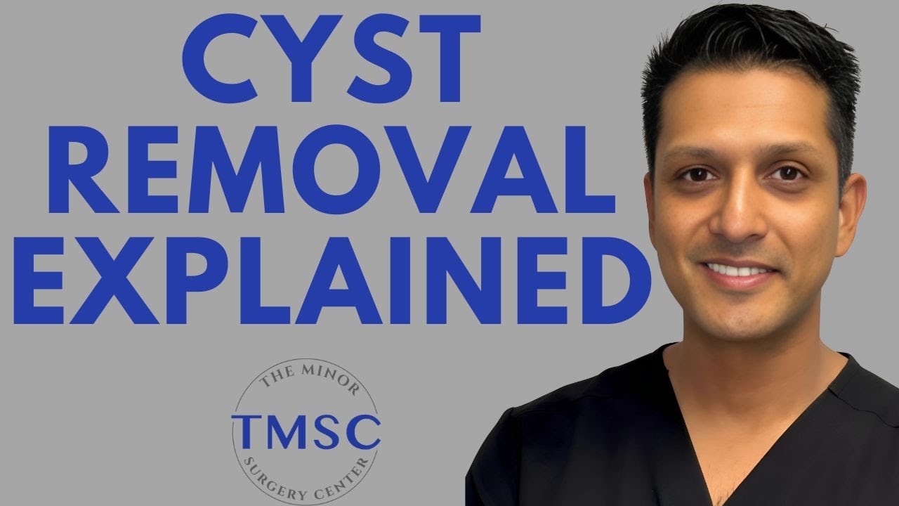 Cyst Removal Explained - The Minor Surgery Center
