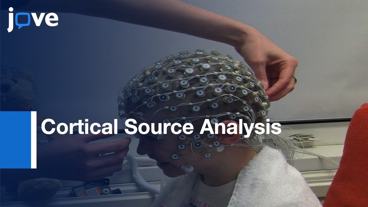 Cortical Source Analysis Of High-Density EEG Recordings In Children l Protocol Preview