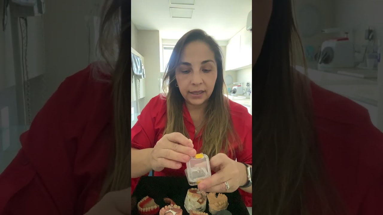 Dica para consultas e exemplos de prótese 