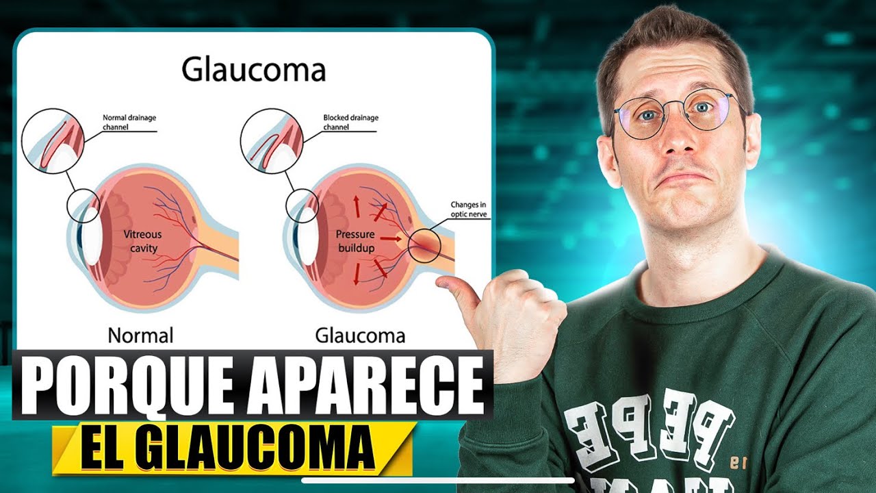 GLAUCOMA: ¿Qué lo Causa? ¿Cómo se Desarrolla? 🧐