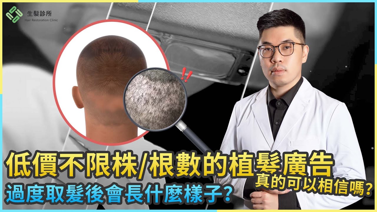 低價不限株/根數的植髮廣告真的可以相信嗎？過度取髮後會長什麼樣子？｜生髮植髮專家柯博桓醫師