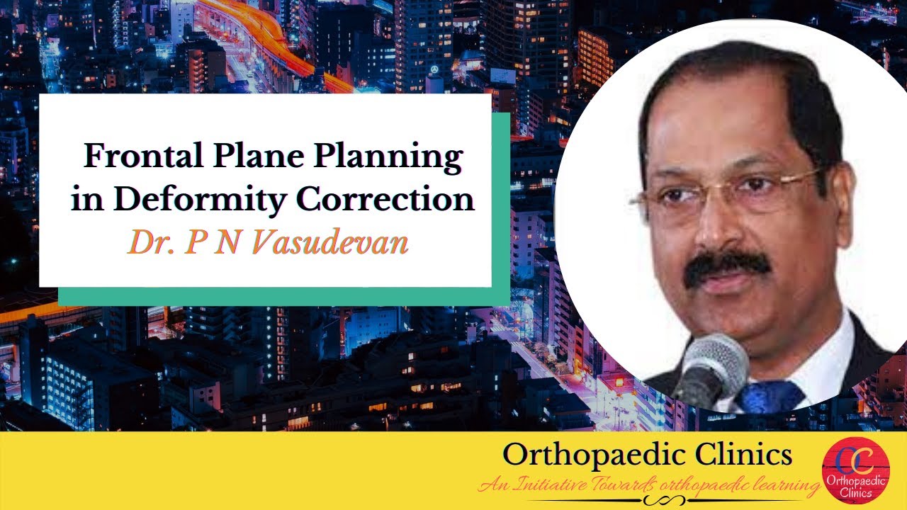 Frontal Plane Planning in Deformity Correction - Dr. P N Vasudevan