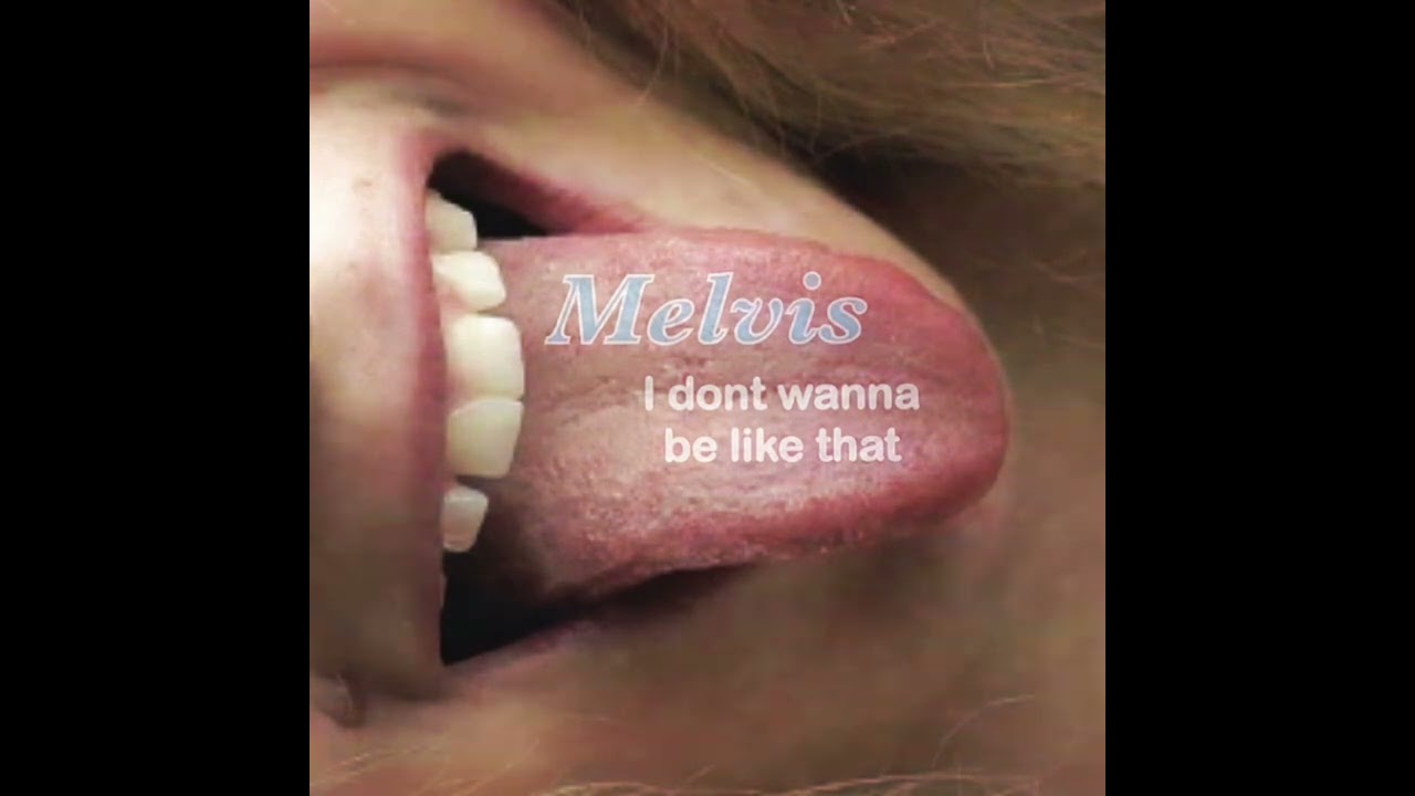 I dont wanna be like that - Melvis