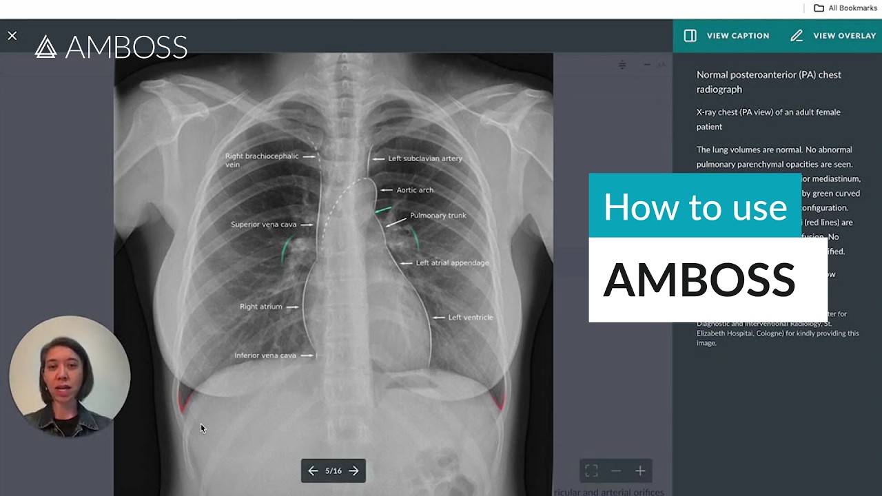 How to use AMBOSS for MD Students: Unlocking Success in In-House Exams and Step 1