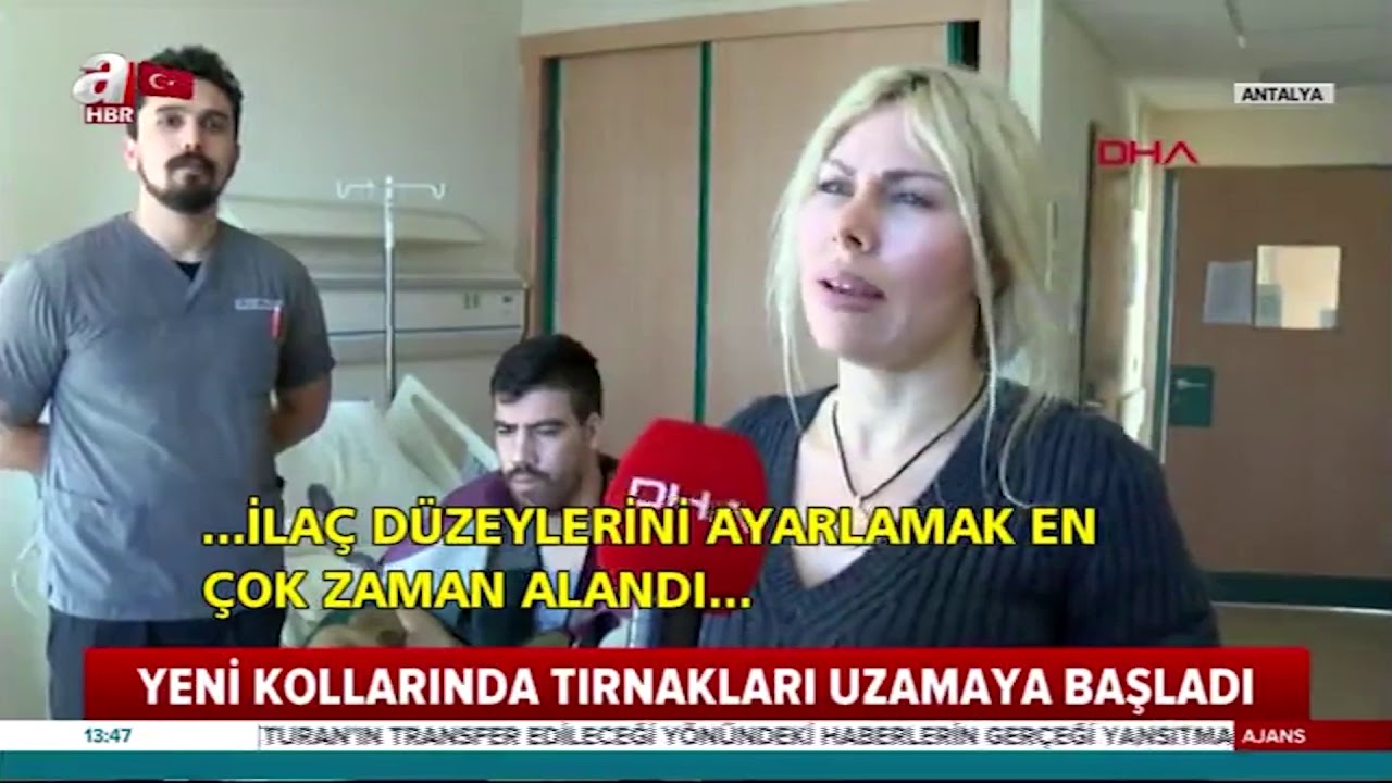 Çift Kol Nakli Yapılan Hastanın Tırnakları Uzamaya Başladı