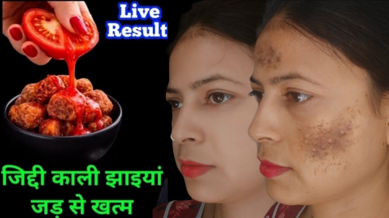 1 ही दिन में चेहरे को इतना गोरा कर देगा यह जबरदस्त नुस्खा देख कर हैरान हो जाएंगे | aalu scrub |