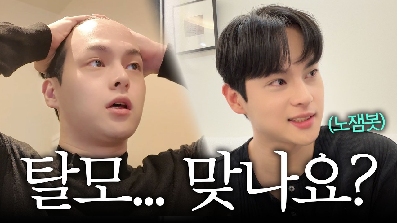 잘생긴 남자에게 탈모가 오면 생기는 일