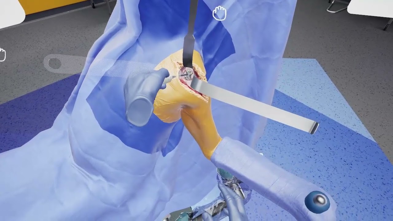 Tornier Perform Glenoid - Anatomic: App Walkthrough