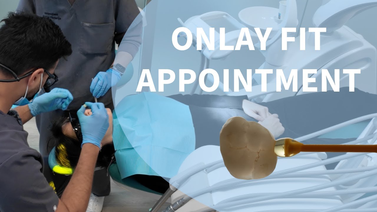 Onlay Fit appointment