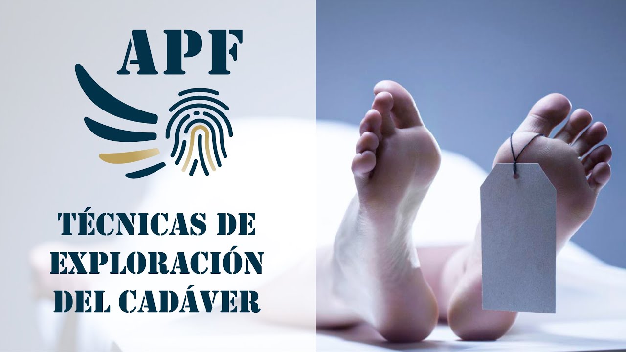 Técnicas de exploración del cadáver.