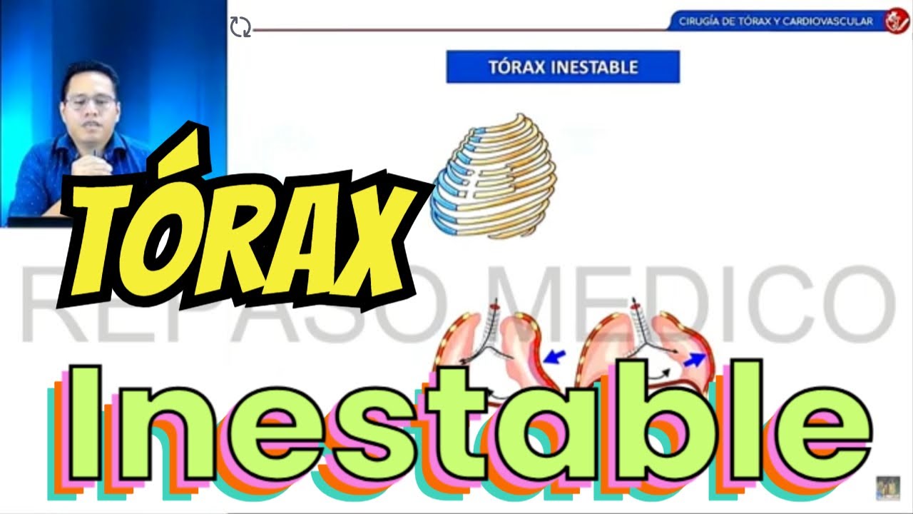 T&oacute;rax Inestable / Qx Medic