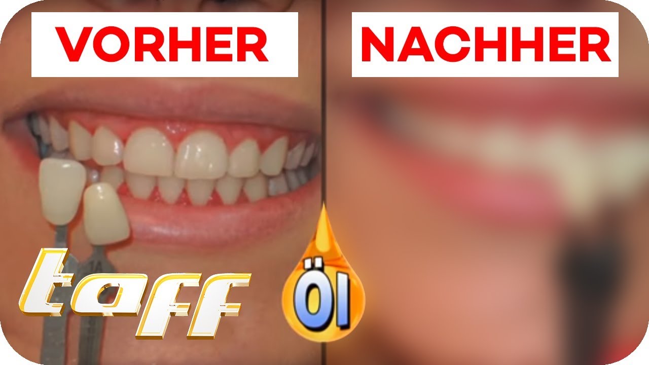 Endlich weiße Zähne - 3 DIY-Beautyprodukte im Test | taff | ProSieben