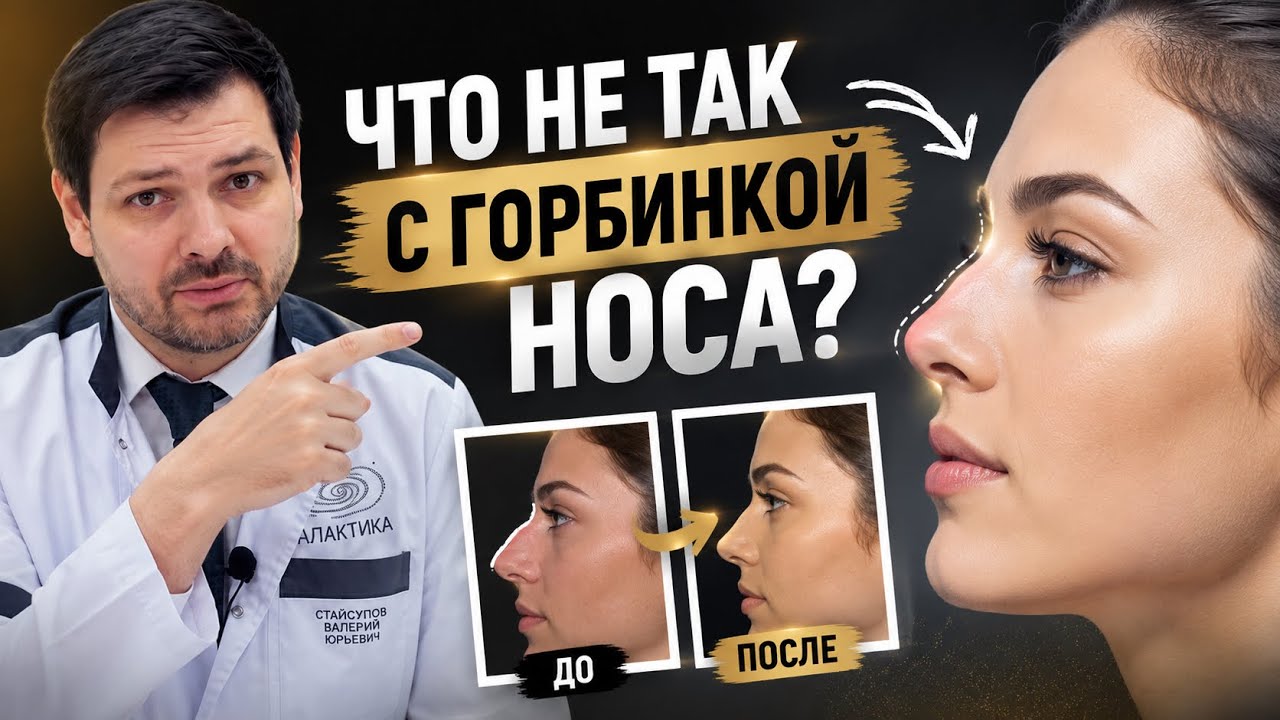 Откуда берется горбинка?