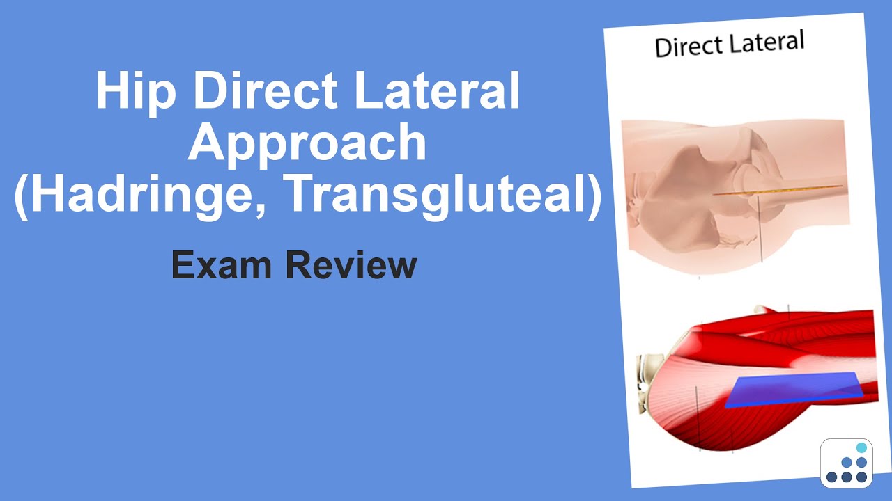 Hip Direct Lateral Approach (Hadringe or Transgluteal) Exam Review  - Doug Padgett, MD