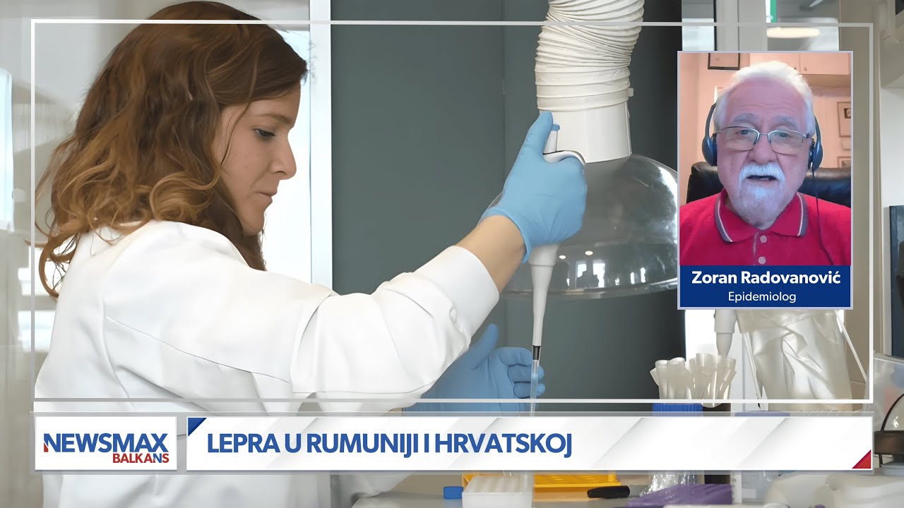 Epidemiolog Zoran Radovanović o lepri: Bezbedni smo, guba pripada pro&scaron;losti &scaron;to se nas tiče