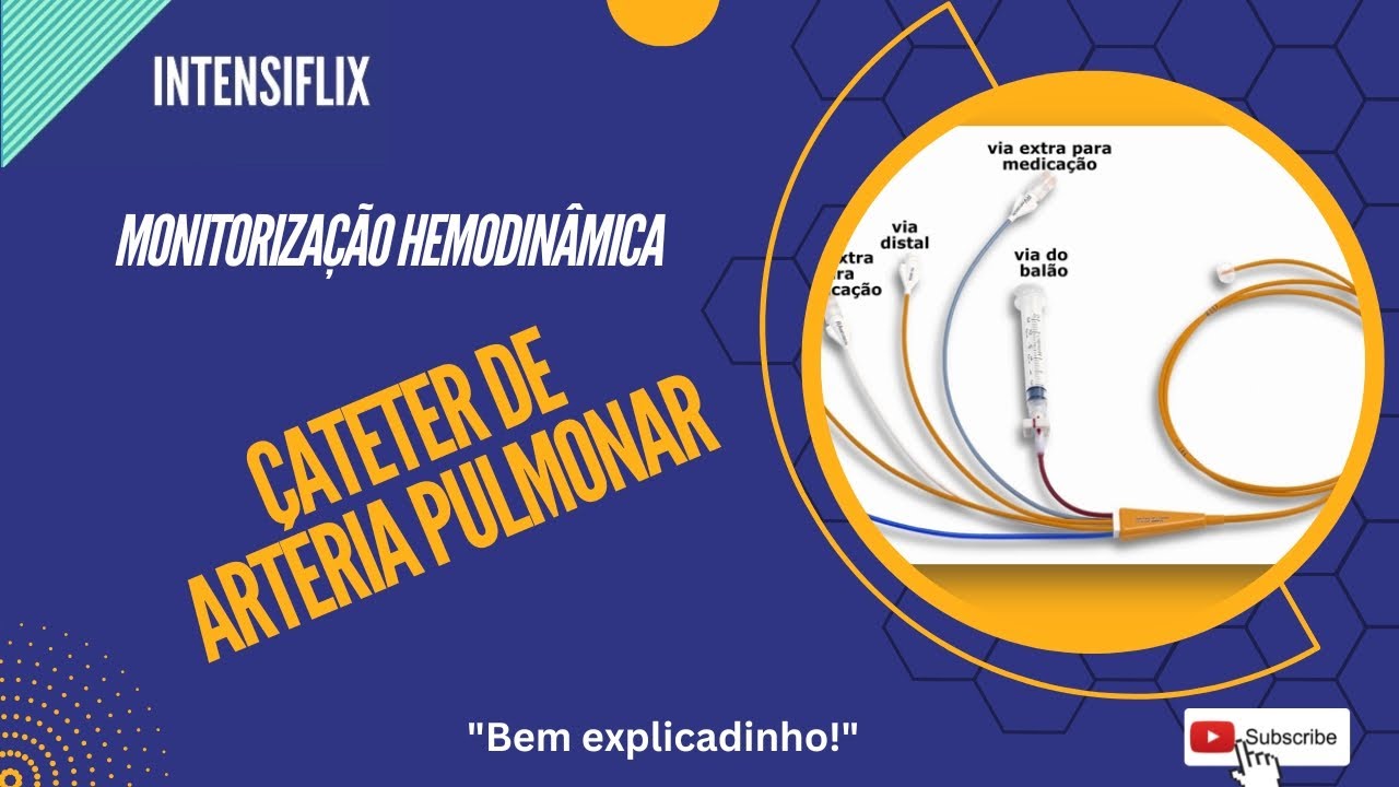 Monitorização Hemodinâmica com Cateter de Artéria Pulmonar (Cateter de Swan-Ganz).