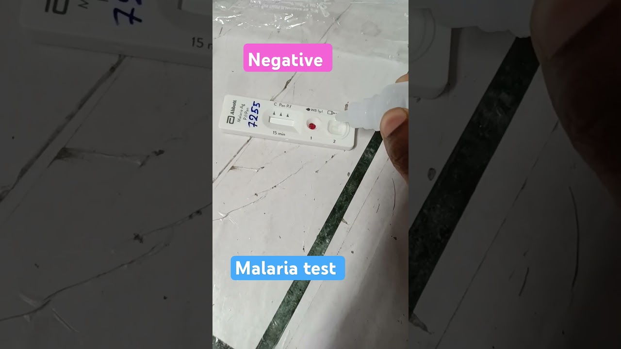 How to do malaria test with kit.malaria test🦟 #malaria diagnosis #youtube shorts#dmlt