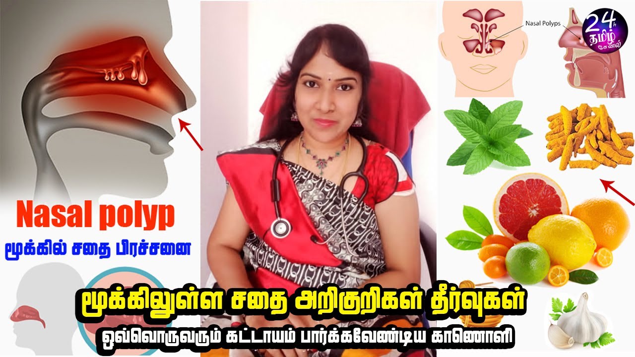 மூக்கில் சதை அறிகுறிகள் வைத்தியம் | nasal polyps symptoms remedy in tamil | Dr.shanthi krishna ragu|