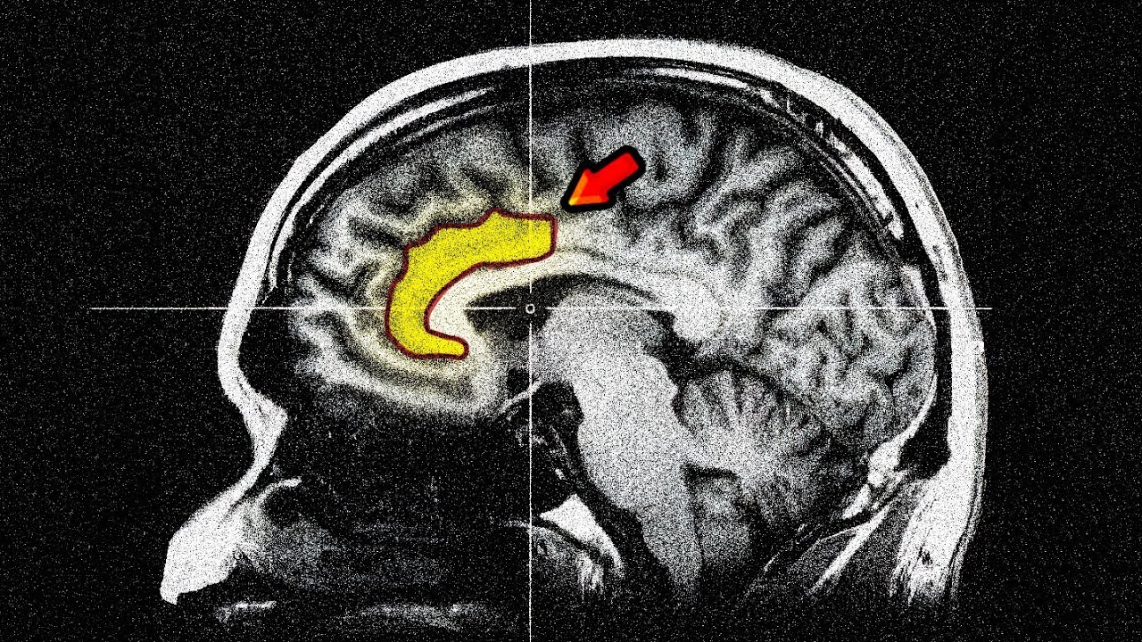 What Happens When You ACTIVATE This BRAIN Area?