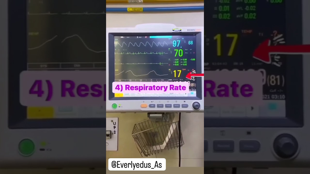 #Basics to reading a patient's monitor # Pulse, SpO2, BP, Temp ##🙂
