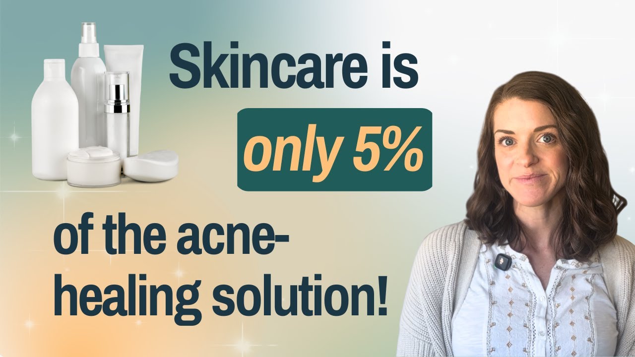 Skincare is only 5% of the acne healing solution