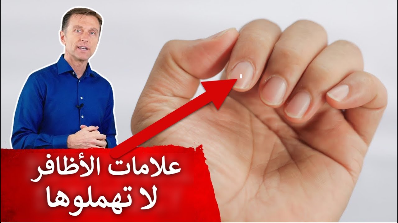 ١٥ علامة على الأظافر تدل على أمراض ونقص فيتامينات ومعادن فلا تهملوها!