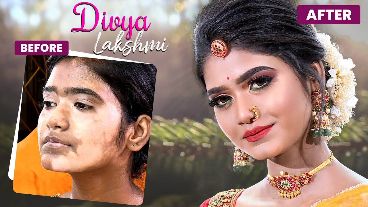 Bridal Makeup for Vitiligo Skin Tone | MUA Karthika Shyam | B3 Bridal Studio