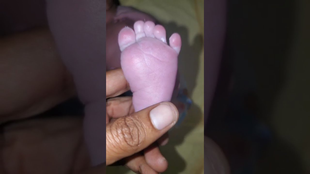 Doctor Checking Newborn Baby Feet, Hands and Face in NICU | Detailed Baby Health Examination