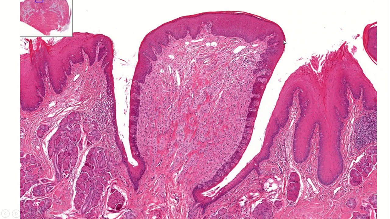 HISTOLOGÍA DE LENGUA