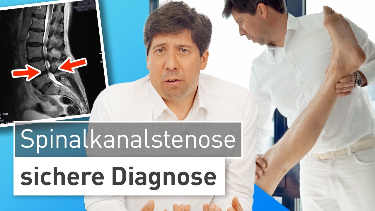 Spinalkanalstenose - häufige Ursache von Beinschmerzen richtig erkennen! ⚠️