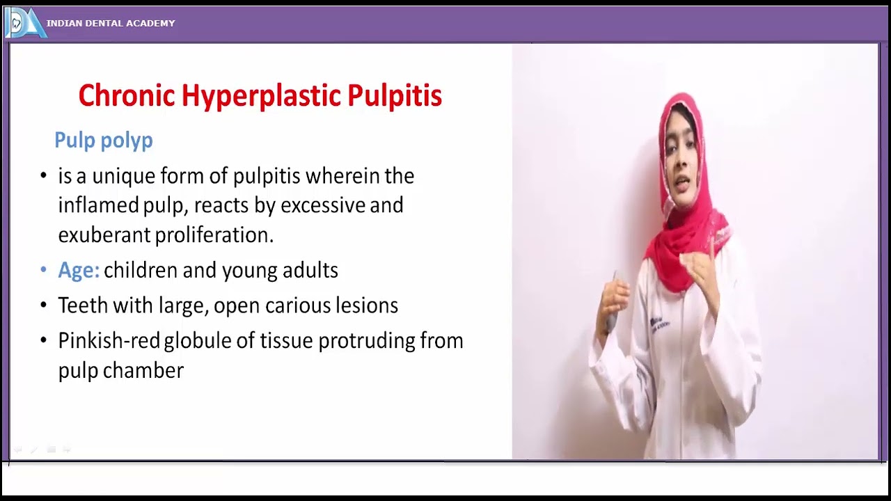Diseases of Pulp #HAAD#DHA#INDIANDENTALACADEMY